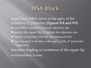 target area: MSA nerve at the apex of the
maxillary 2nd
premolar (figures 9-8 and 9-9)
 mandible extended towards injection site
 stretch the upper lip to tighten the injection site
 needle is inserted into the mucobuccal fold
 tip is located well above the apex of the 2nd
premolar
 figure 9-11
 harmless tingling or numbness of the upper lip
 overinsertion is rare
 