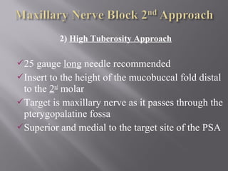 2) High Tuberosity Approach
25 gauge long needle recommended
Insert to the height of the mucobuccal fold distal
to the 2nd
molar
Target is maxillary nerve as it passes through the
pterygopalatine fossa
Superior and medial to the target site of the PSA
 