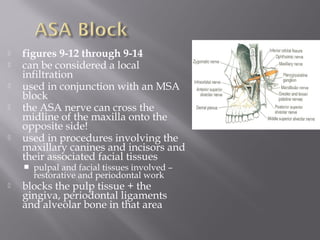  figures 9-12 through 9-14
 can be considered a local
infiltration
 used in conjunction with an MSA
block
 the ASA nerve can cross the
midline of the maxilla onto the
opposite side!
 used in procedures involving the
maxillary canines and incisors and
their associated facial tissues
 pulpal and facial tissues involved –
restorative and periodontal work
 blocks the pulp tissue + the
gingiva, periodontal ligaments
and alveolar bone in that area
 