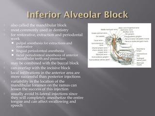  also called the mandibular block
 most commonly used in dentistry
 for restorative, extraction and periodontal
work
 pulpal anesthesia for extractions and
restorative
 lingual periodonteal anesthesia
 facial periodonteal anesthesia of anterior
mandibular teeth and premolars
 may be combined with the buccal block
 can overlap with the incisive block
 local infiltrations in the anterior area are
more successful than posterior injections
 variability in the location of the
mandibular foramen on the ramus can
lessen the success of this injection
 usually avoid bi-lateral injections since
they will completely anesthetize the entire
tongue and can affect swallowing and
speech
 