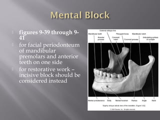  figures 9-39 through 9-
41
 for facial periodonteum
of mandibular
premolars and anterior
teeth on one side
 for restorative work –
incisive block should be
considered instead
 