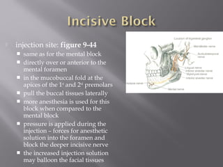  injection site: figure 9-44
 same as for the mental block
 directly over or anterior to the
mental foramen
 in the mucobuccal fold at the
apices of the 1st
and 2nd
premolars
 pull the buccal tissues laterally
 more anesthesia is used for this
block when compared to the
mental block
 pressure is applied during the
injection – forces for anesthetic
solution into the foramen and
block the deeper incisive nerve
 the increased injection solution
may balloon the facial tissues
 