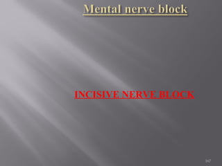 167
INCISIVE NERVE BLOCK
 