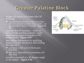  target: GP nerve as it enters the GP
foramen
 located at the junction of the maxillary
alveolar process and the hard palate – at
the maxillary 2nd or 3rd
molar – figure 9-
19
 palpate the GP foramen – midway
between the median palatine raphe
and lingual gingival margin of the
molar tooth – figure 9-21
 can reduce discomfort by applying
pressure to the site before and during
the injection
 produces a dull ache to block pain
impulses
 also slow deposition of anesthesia will
also help
 needle is inserted at a 90 degree angle
to the palate – figure 9-22
 