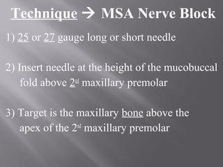 Technique  MSA Nerve Block
1) 25 or 27 gauge long or short needle
2) Insert needle at the height of the mucobuccal
fold above 2nd
maxillary premolar
3) Target is the maxillary bone above the
apex of the 2nd
maxillary premolar
 