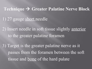Technique  Greater Palatine Nerve Block
1) 27 gauge short needle
2) Insert needle in soft tissue slightly anterior
to the greater palatine foramen
3) Target is the greater palatine nerve as it
passes from the foramen between the soft
tissue and bone of the hard palate
 