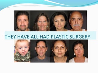 THEY HAVE ALL HAD PLASTIC SURGERY
 