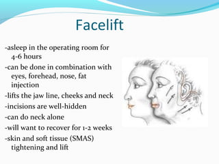 Facelift
-asleep in the operating room for
   4-6 hours
-can be done in combination with
   eyes, forehead, nose, fat
   injection
-lifts the jaw line, cheeks and neck
-incisions are well-hidden
-can do neck alone
-will want to recover for 1-2 weeks
-skin and soft tissue (SMAS)
   tightening and lift
 