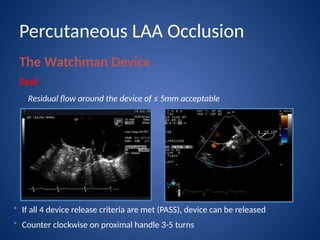 left atrial appendage closure with watchman device | PPTX
