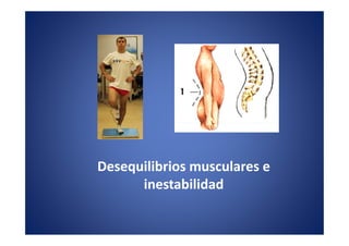 Desequilibrios musculares e
      inestabilidad
 