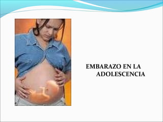 EMBARAZO EN LA
ADOLESCENCIA

 