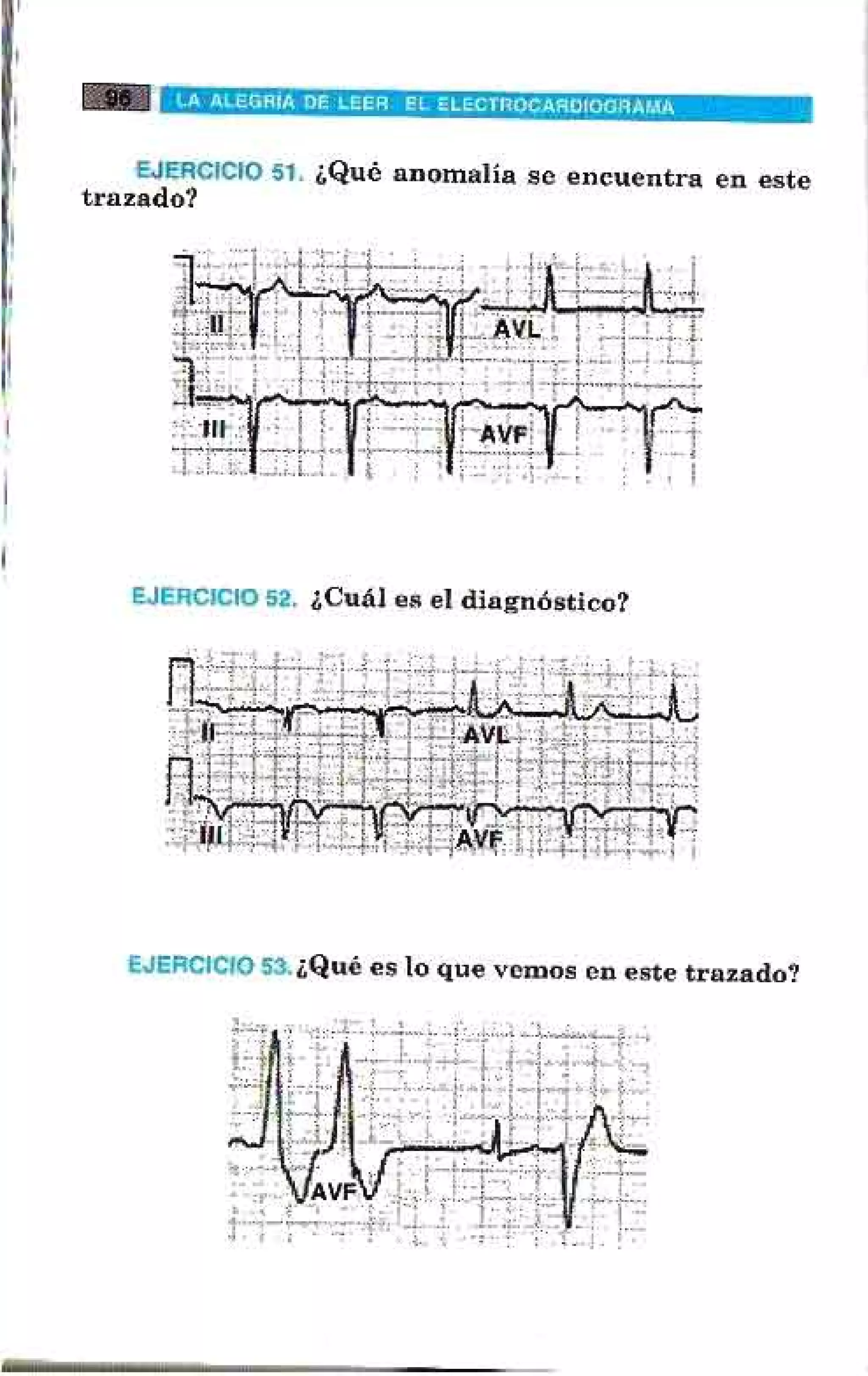 LA ALEGRIA DE LEER EL ELECTROCARDIOGRAMA