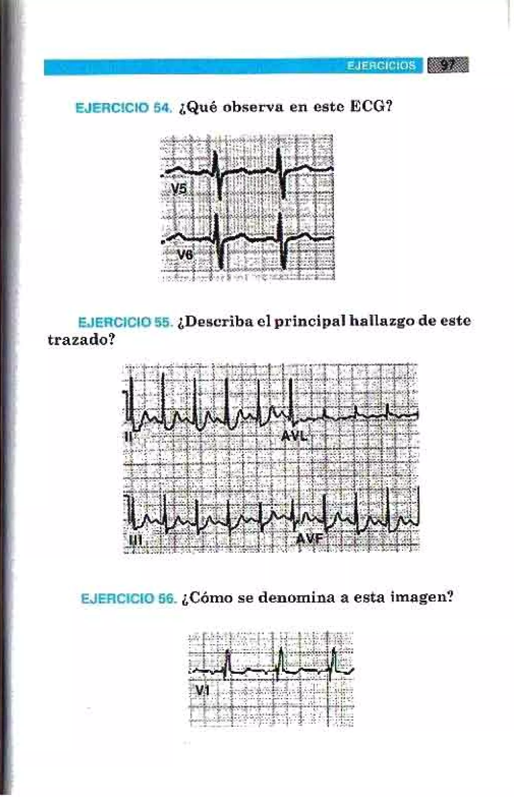LA ALEGRIA DE LEER EL ELECTROCARDIOGRAMA