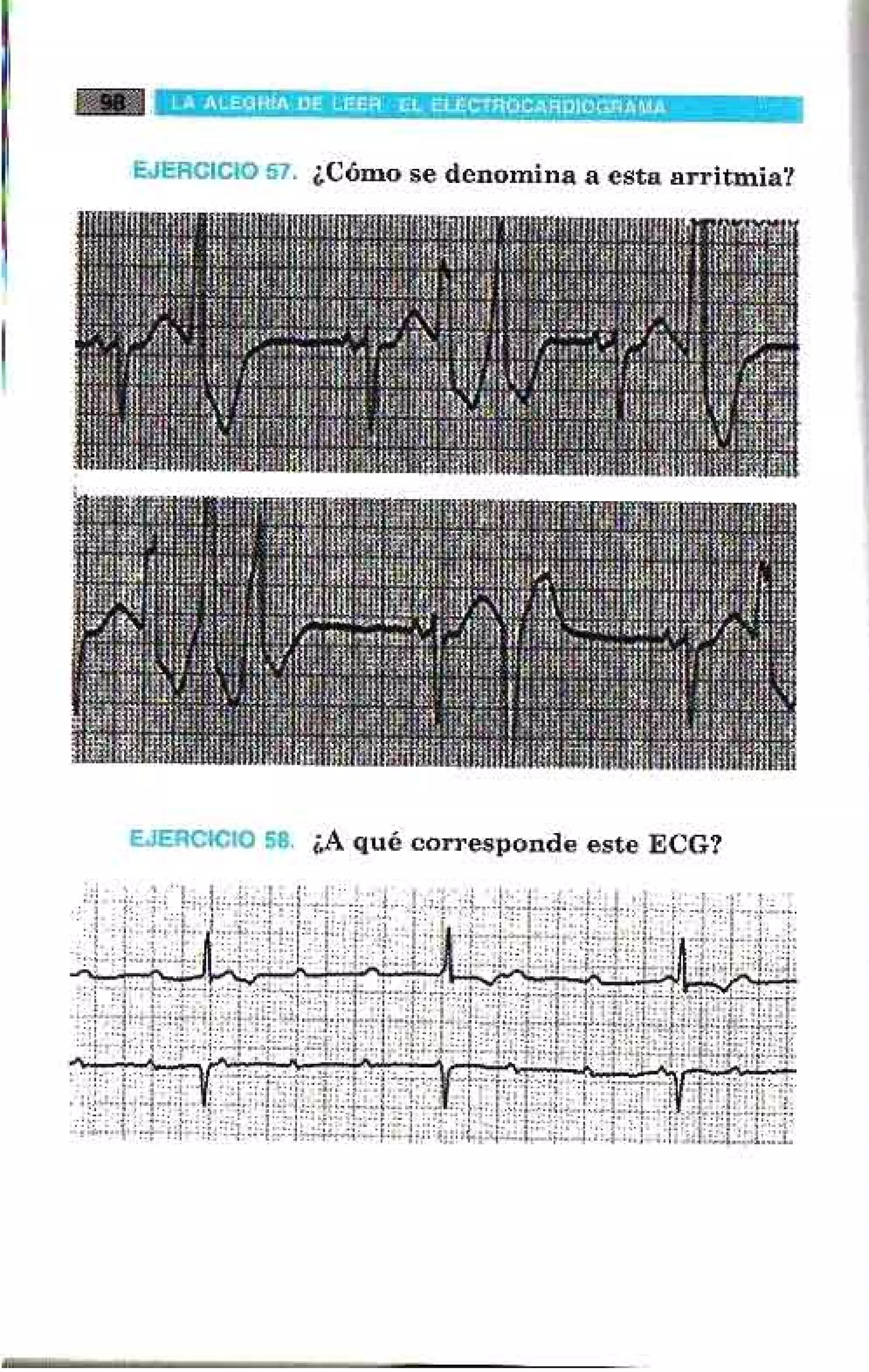LA ALEGRIA DE LEER EL ELECTROCARDIOGRAMA