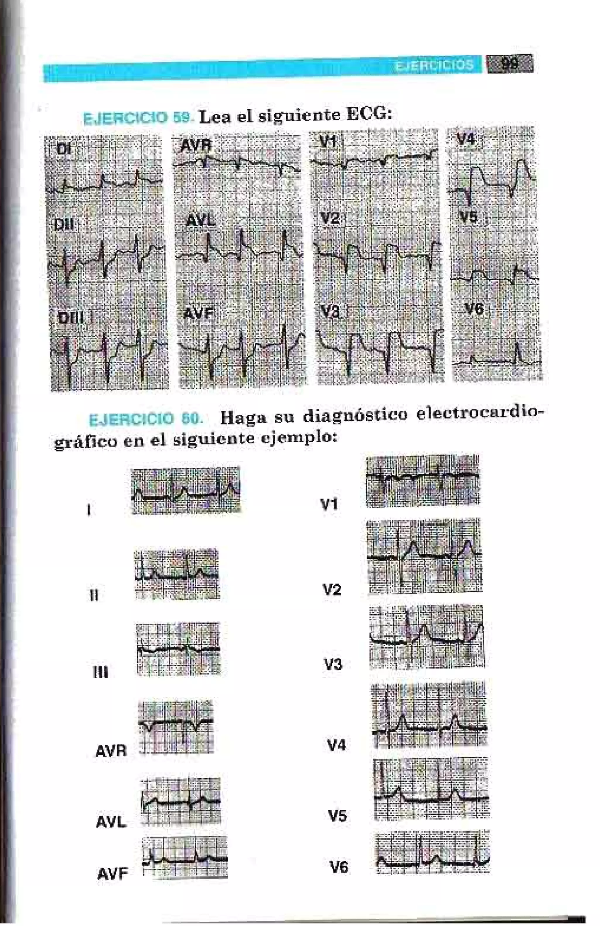 LA ALEGRIA DE LEER EL ELECTROCARDIOGRAMA
