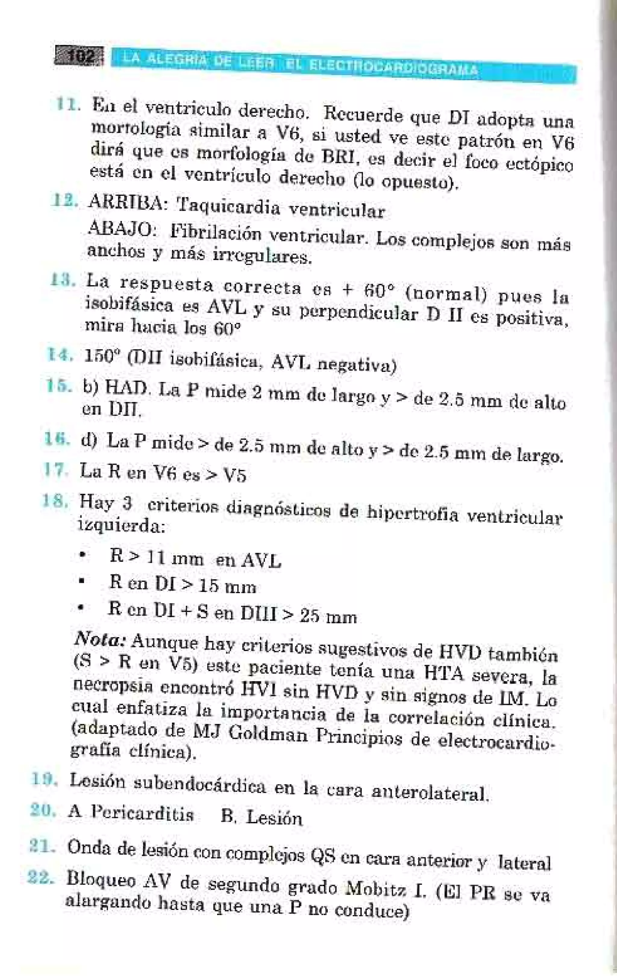 LA ALEGRIA DE LEER EL ELECTROCARDIOGRAMA