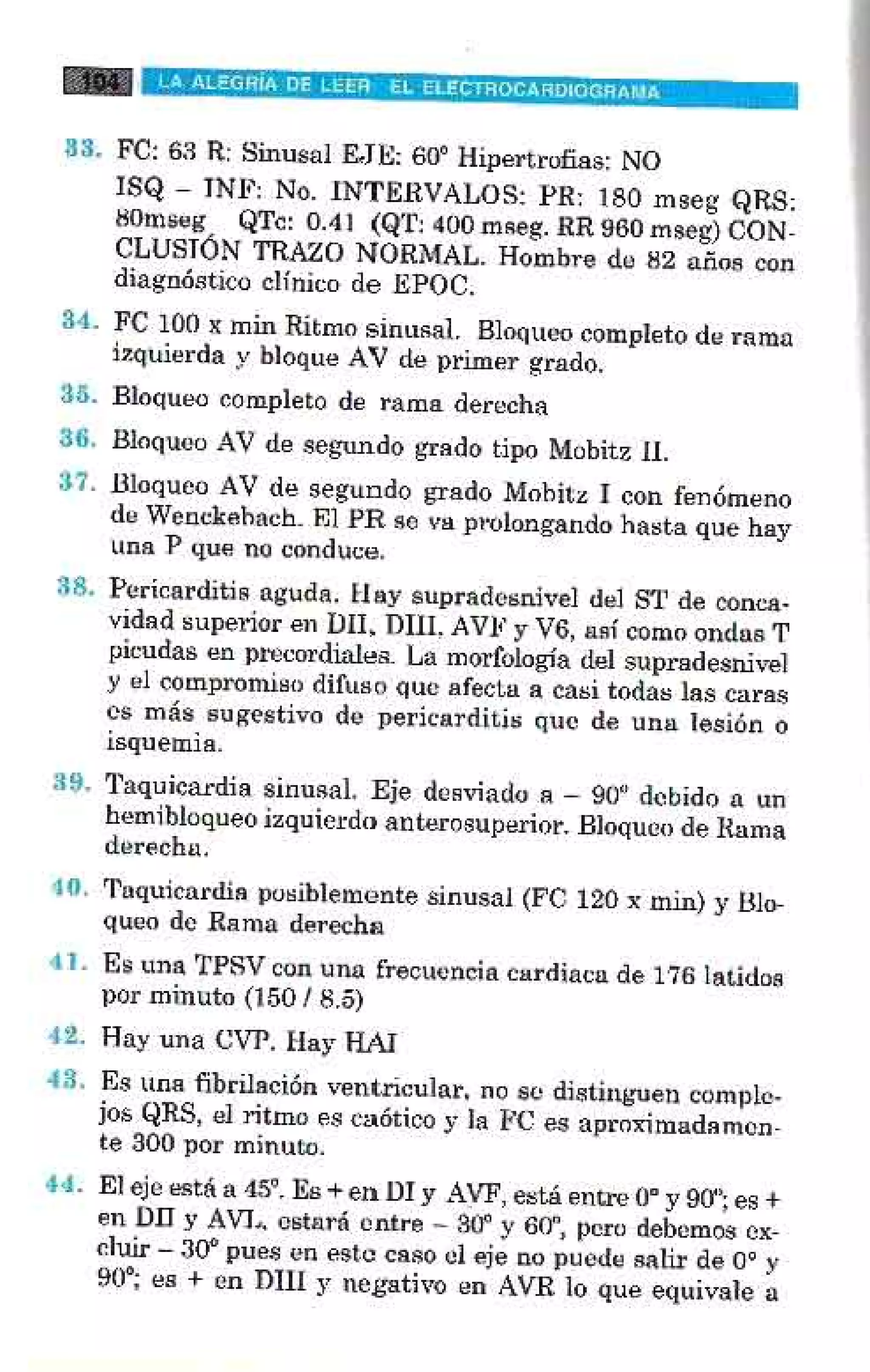 LA ALEGRIA DE LEER EL ELECTROCARDIOGRAMA