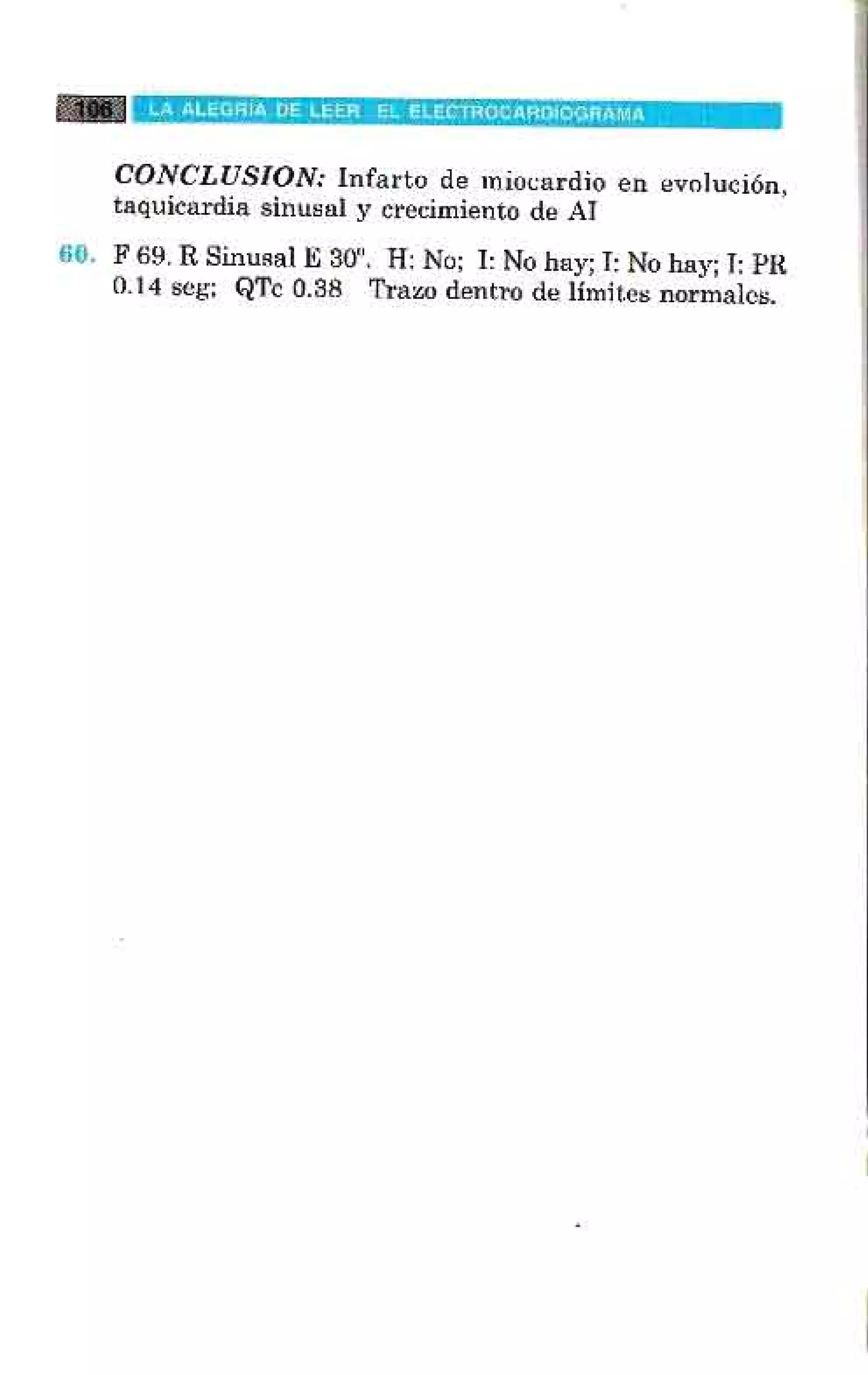 LA ALEGRIA DE LEER EL ELECTROCARDIOGRAMA