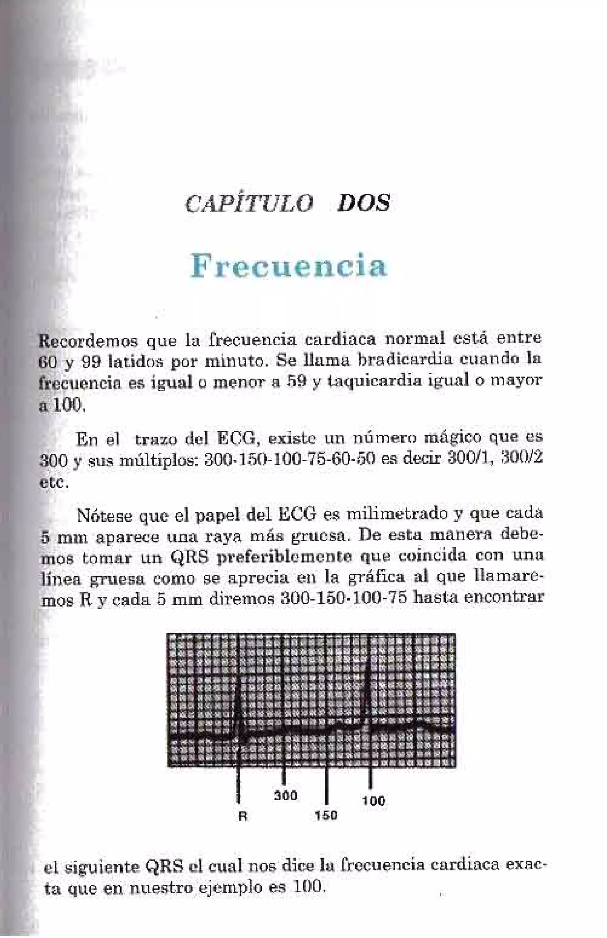LA ALEGRIA DE LEER EL ELECTROCARDIOGRAMA