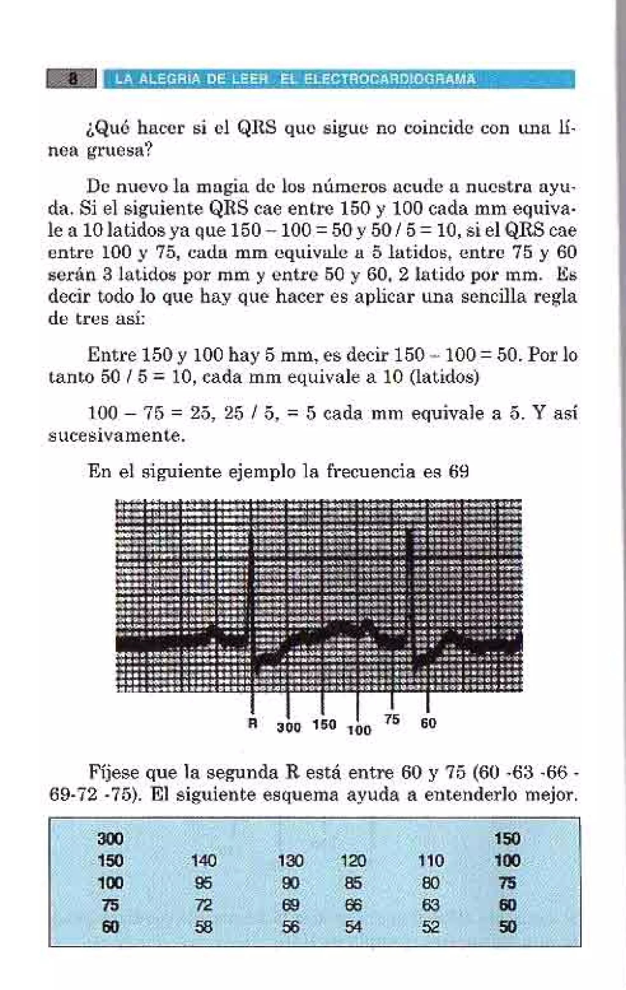 LA ALEGRIA DE LEER EL ELECTROCARDIOGRAMA