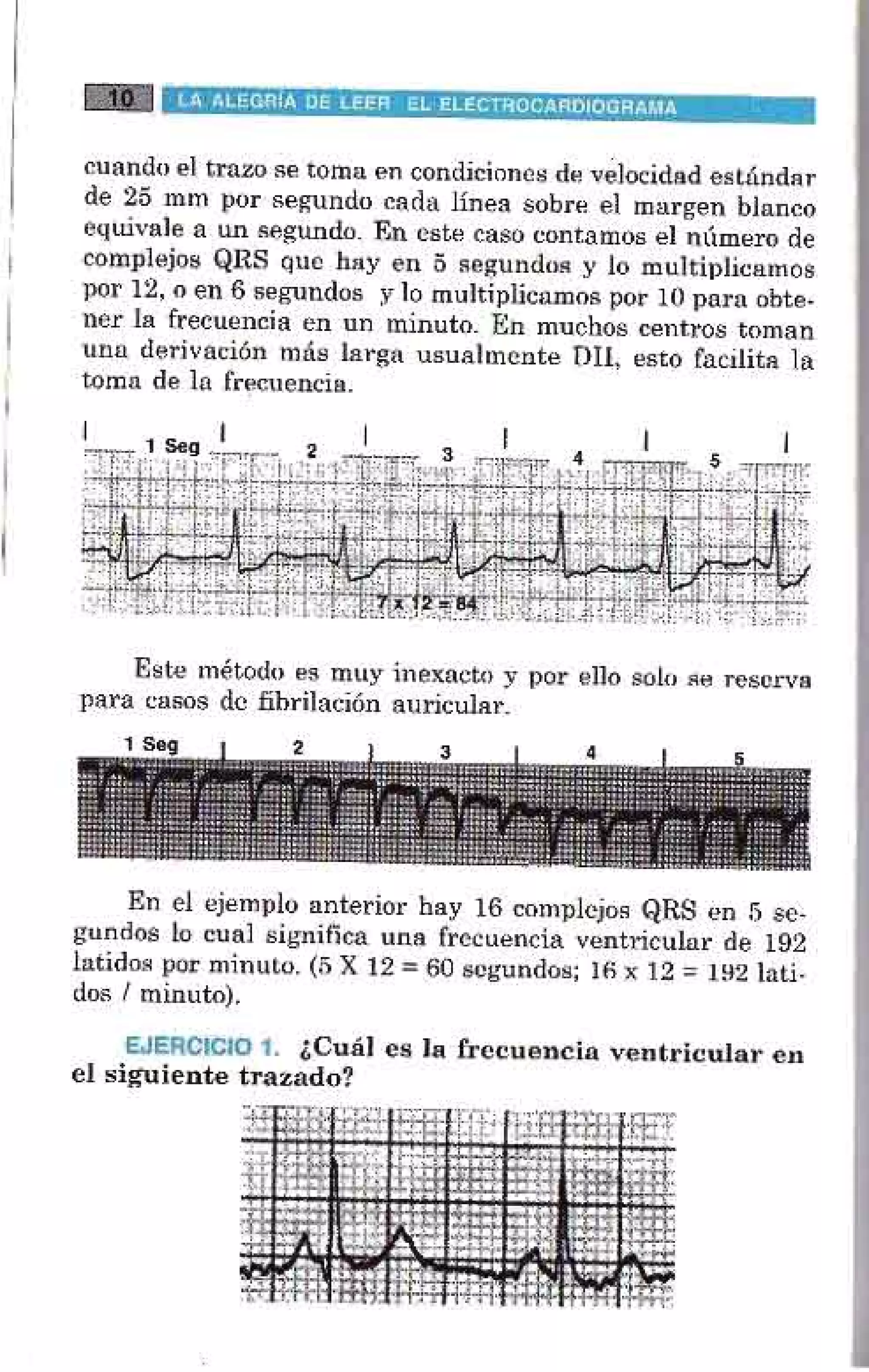 LA ALEGRIA DE LEER EL ELECTROCARDIOGRAMA