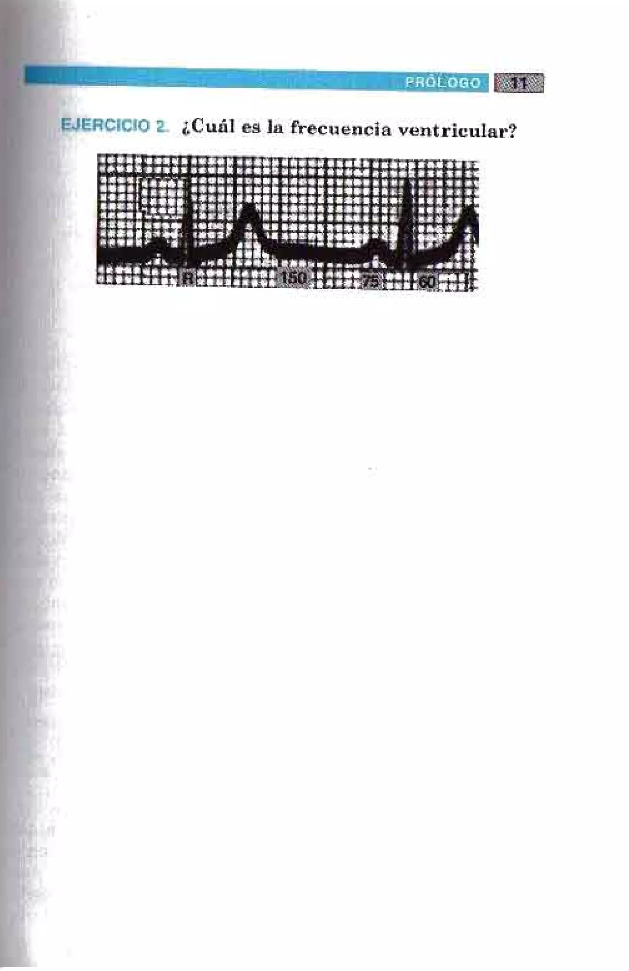 LA ALEGRIA DE LEER EL ELECTROCARDIOGRAMA