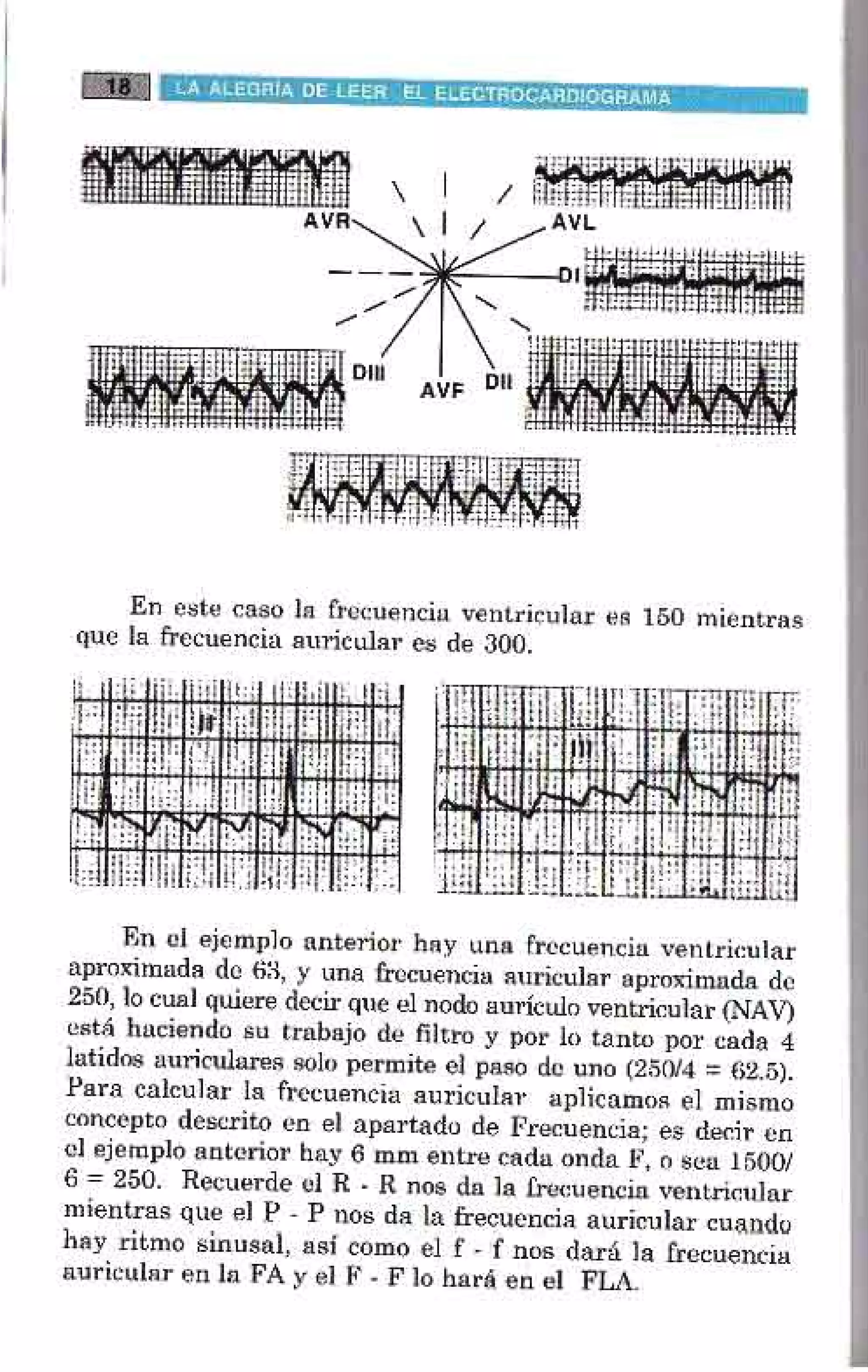 LA ALEGRIA DE LEER EL ELECTROCARDIOGRAMA