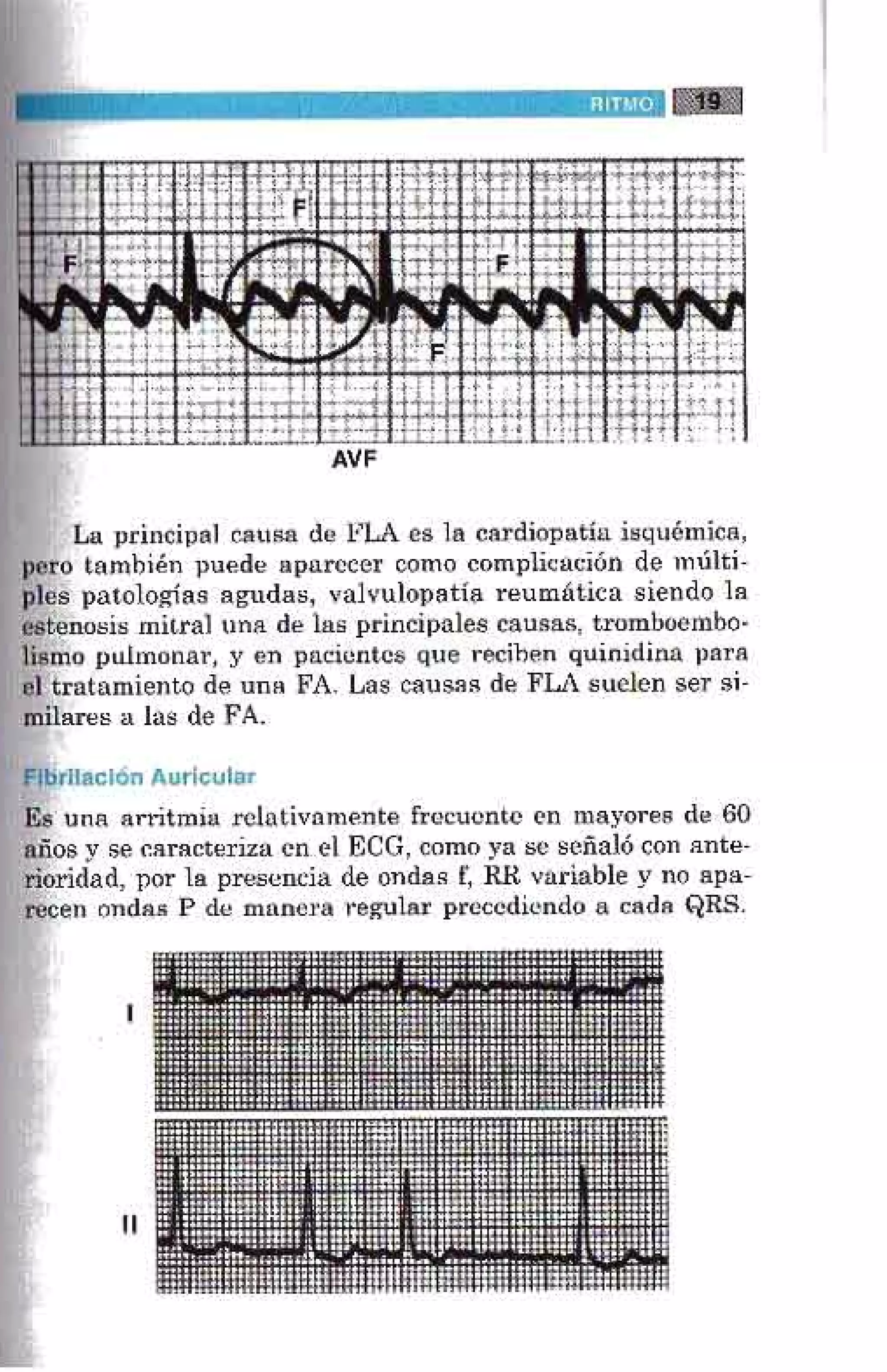 LA ALEGRIA DE LEER EL ELECTROCARDIOGRAMA