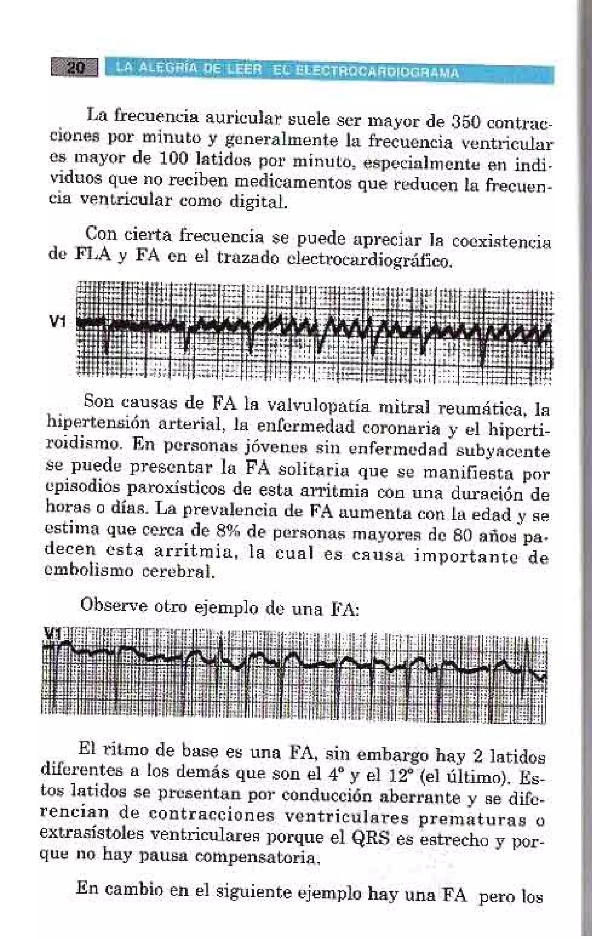 LA ALEGRIA DE LEER EL ELECTROCARDIOGRAMA