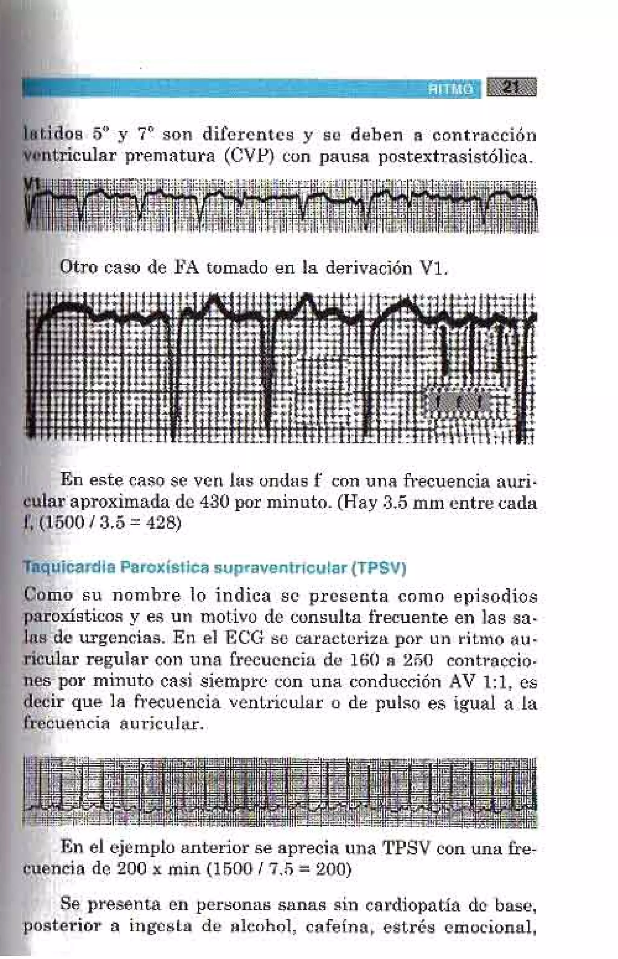 LA ALEGRIA DE LEER EL ELECTROCARDIOGRAMA