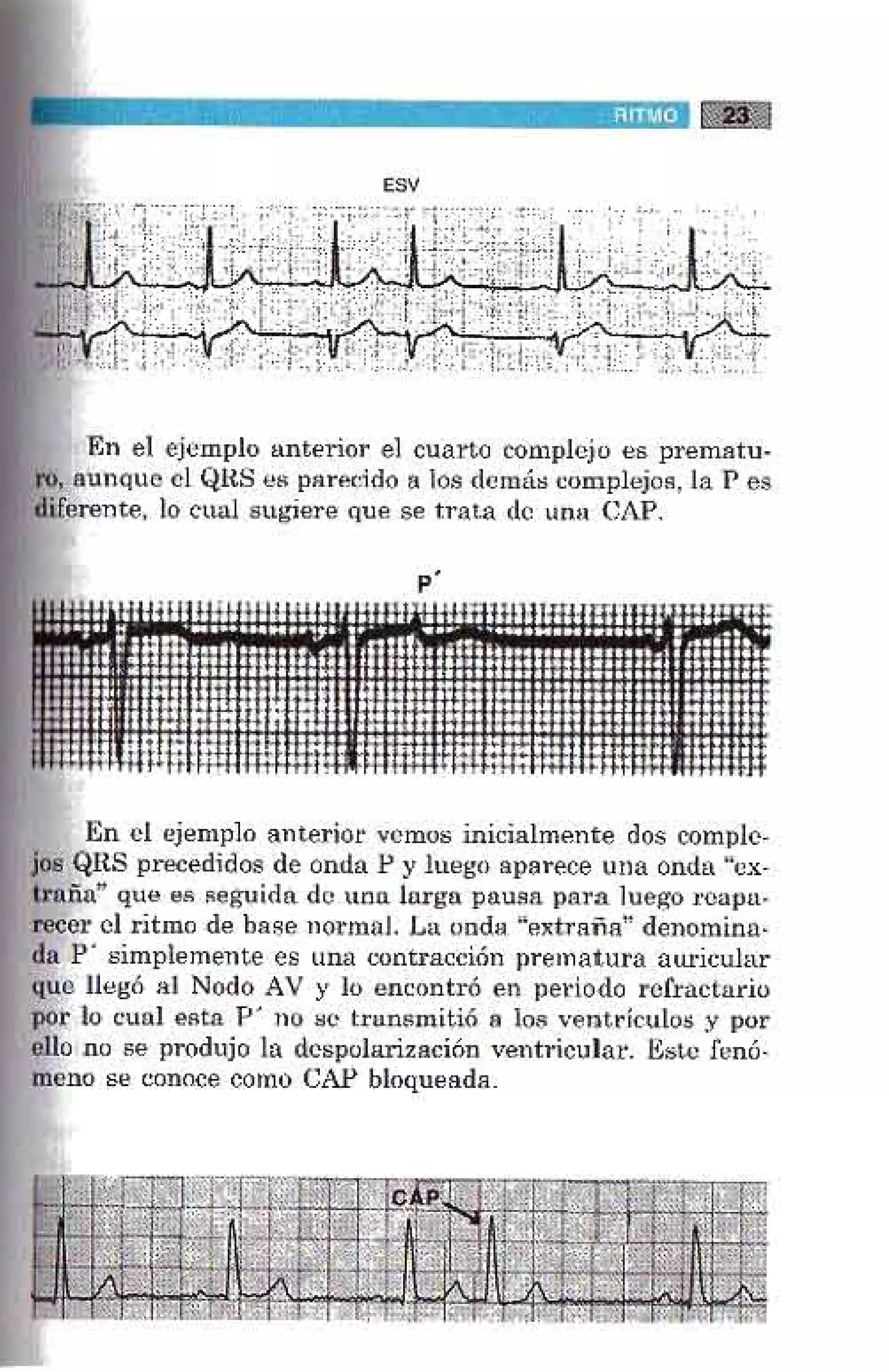 LA ALEGRIA DE LEER EL ELECTROCARDIOGRAMA