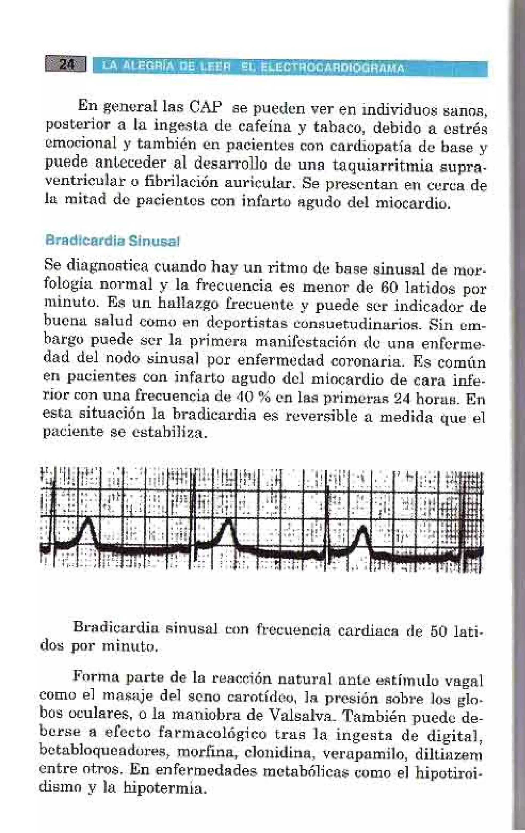 LA ALEGRIA DE LEER EL ELECTROCARDIOGRAMA