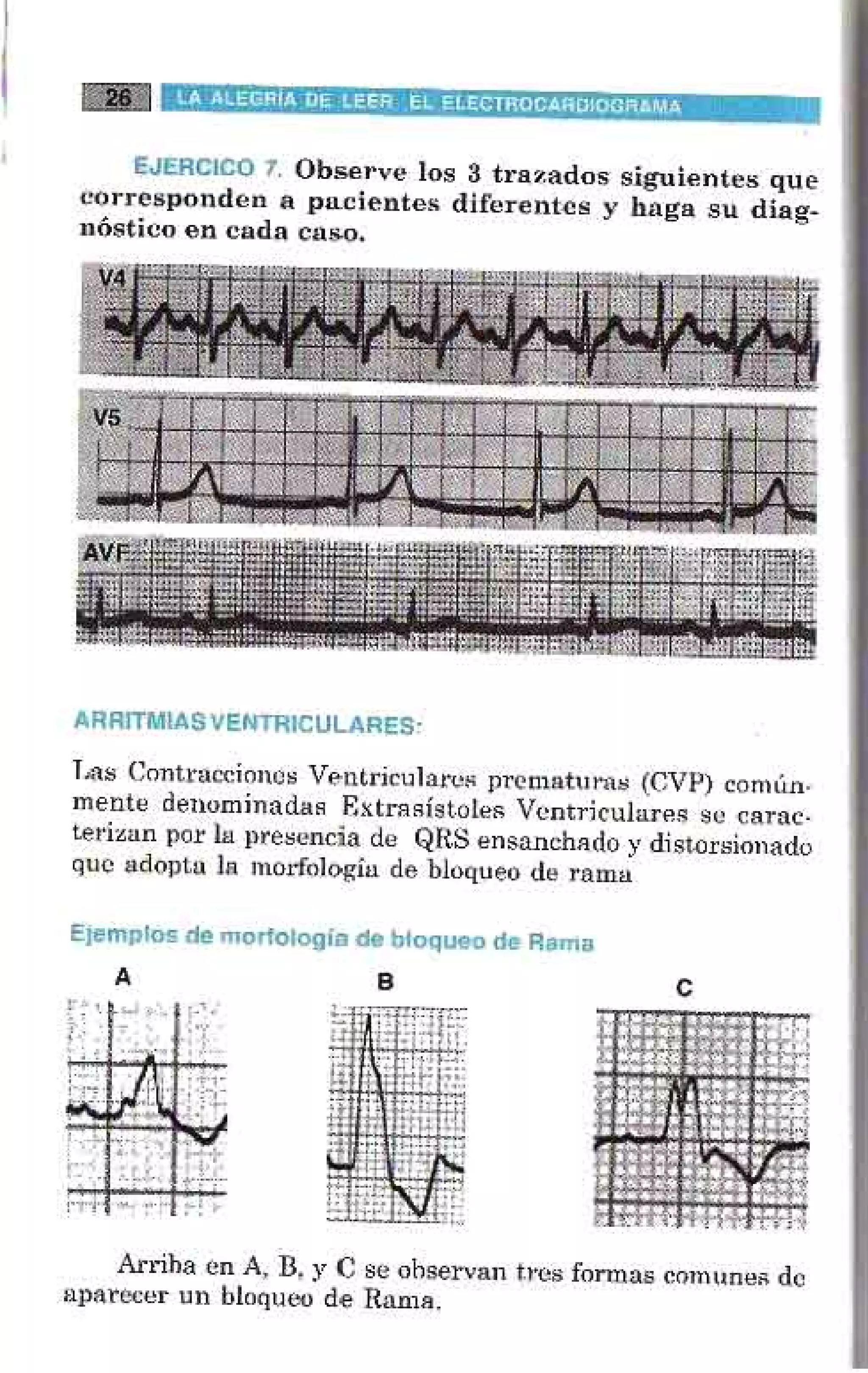 LA ALEGRIA DE LEER EL ELECTROCARDIOGRAMA