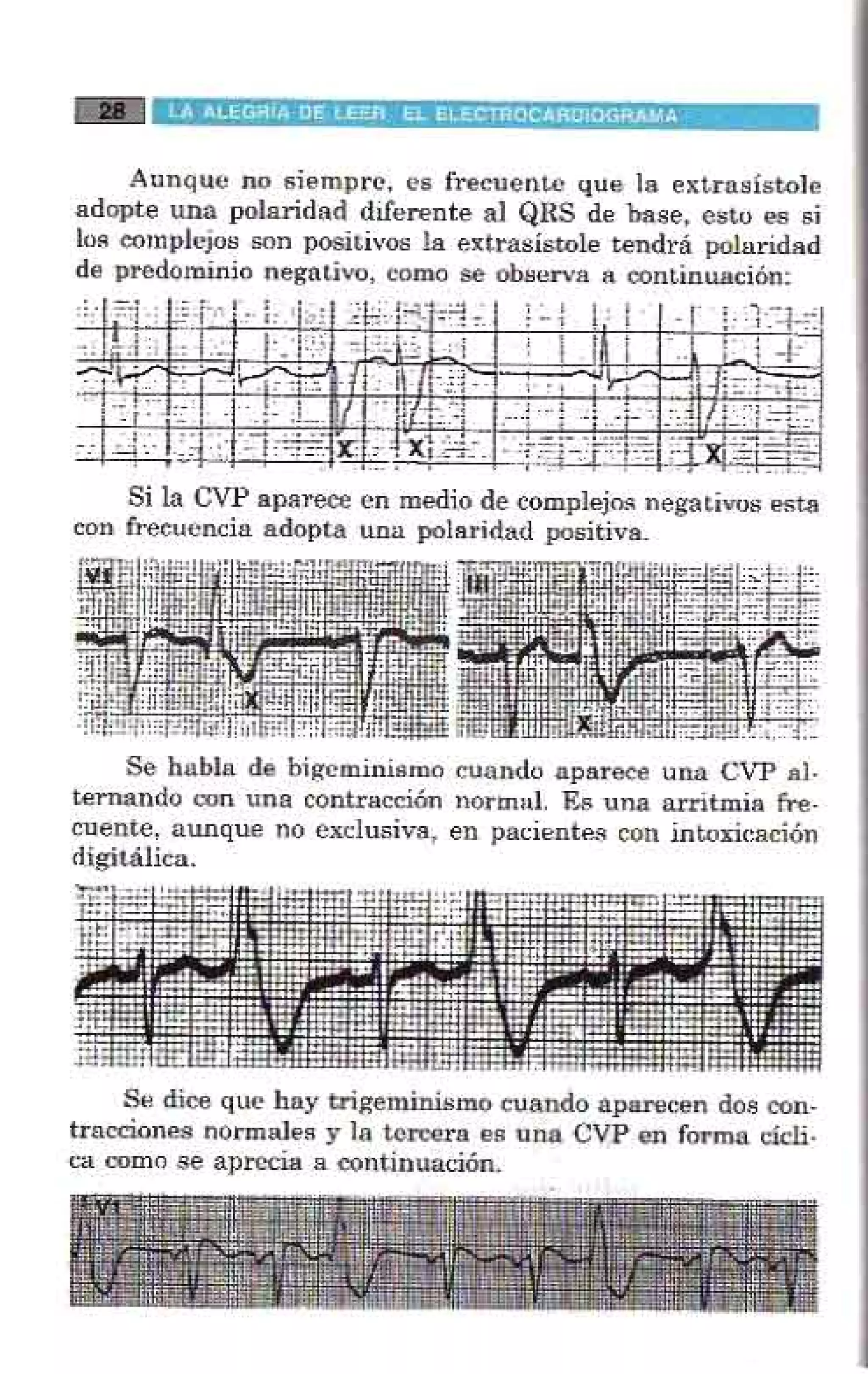 LA ALEGRIA DE LEER EL ELECTROCARDIOGRAMA