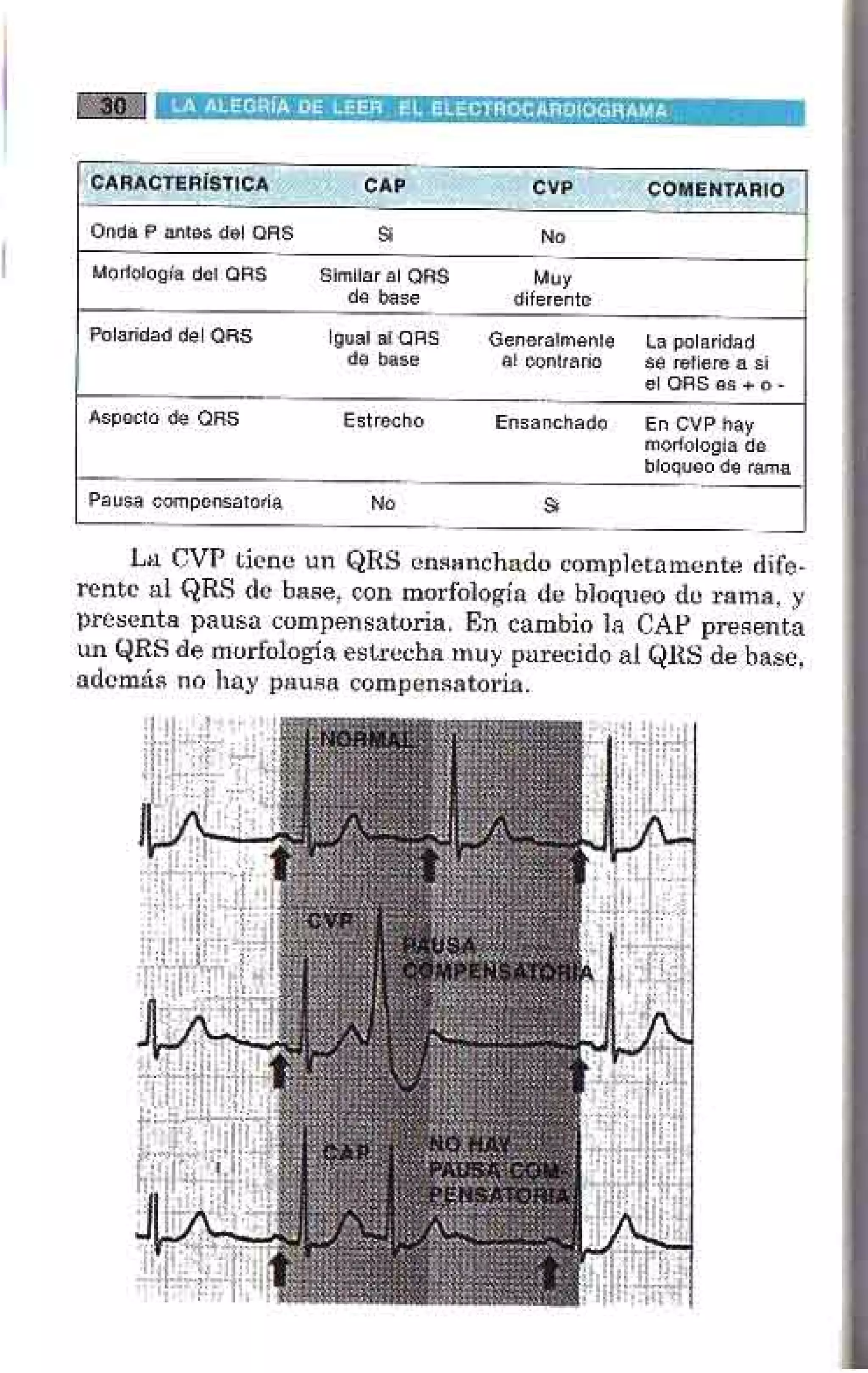 LA ALEGRIA DE LEER EL ELECTROCARDIOGRAMA
