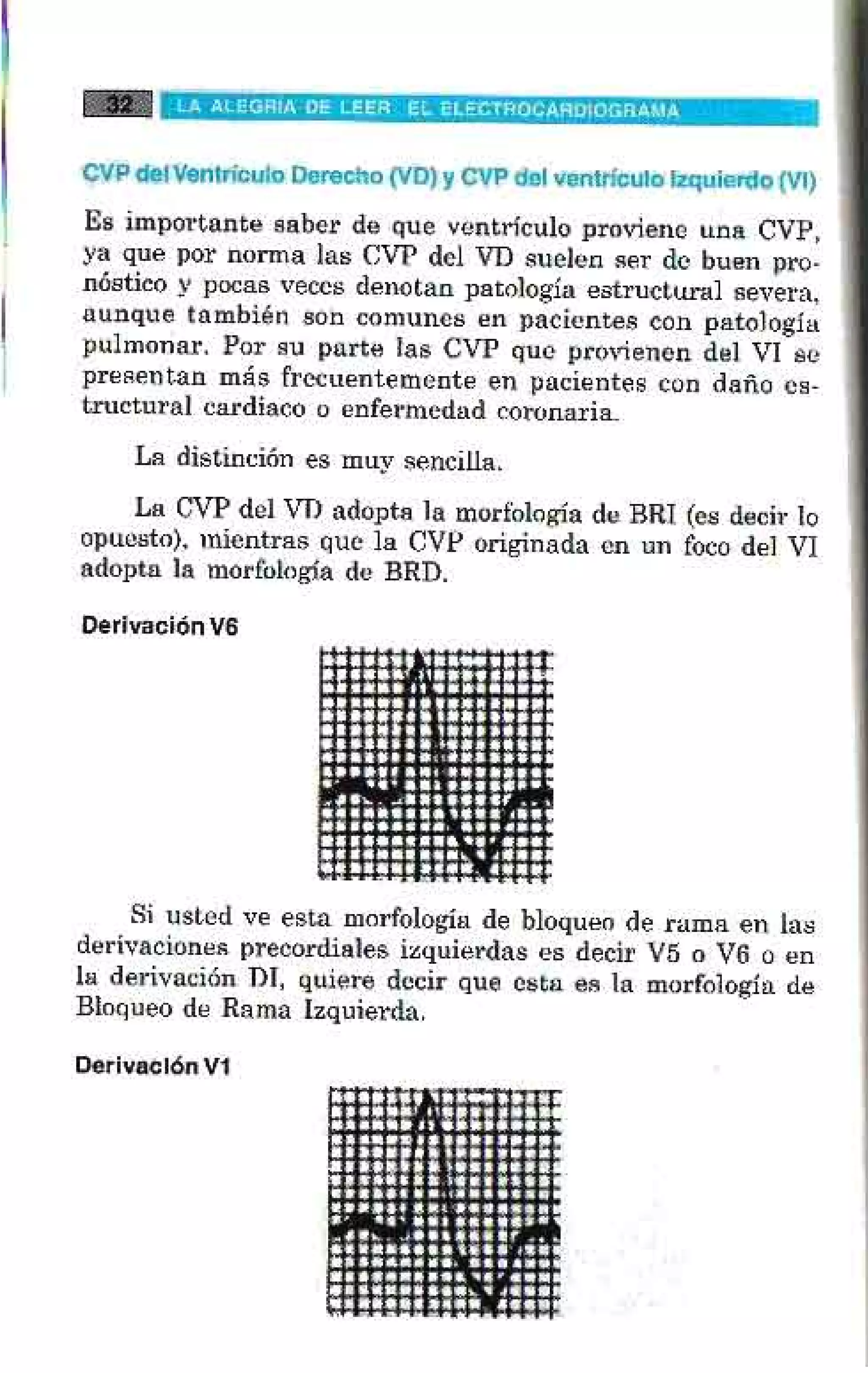 LA ALEGRIA DE LEER EL ELECTROCARDIOGRAMA