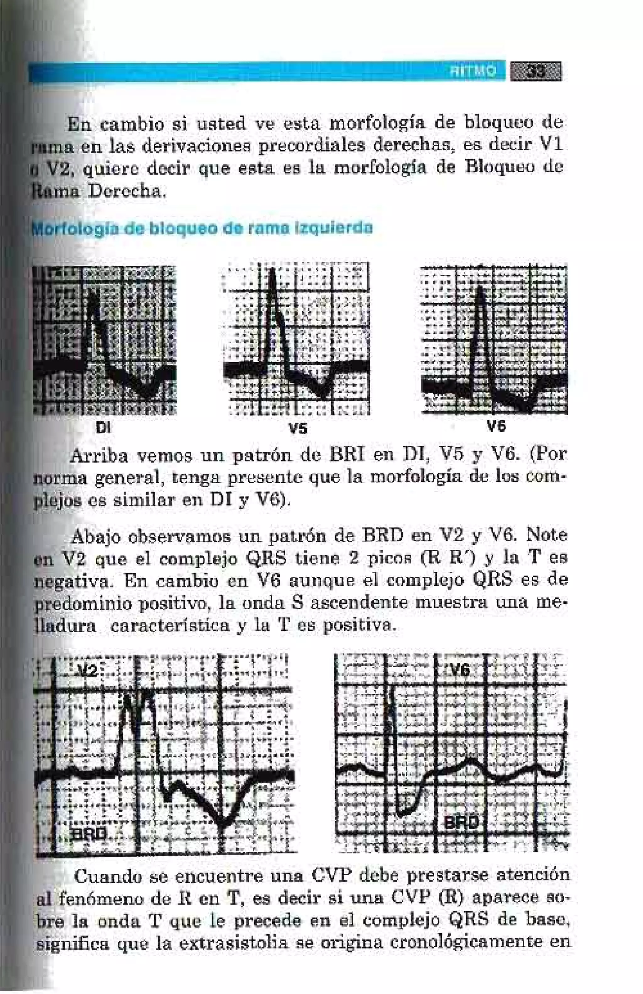 LA ALEGRIA DE LEER EL ELECTROCARDIOGRAMA