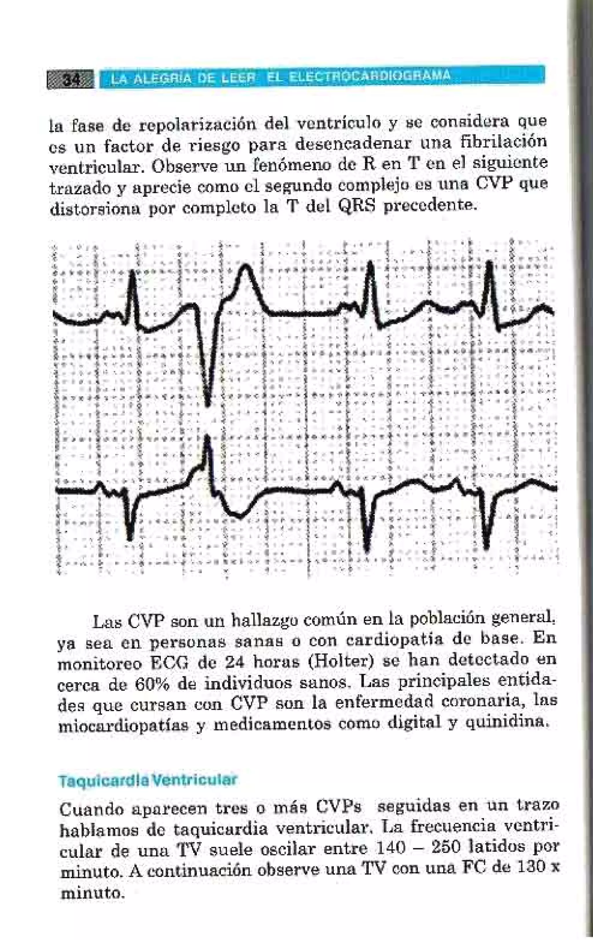 LA ALEGRIA DE LEER EL ELECTROCARDIOGRAMA