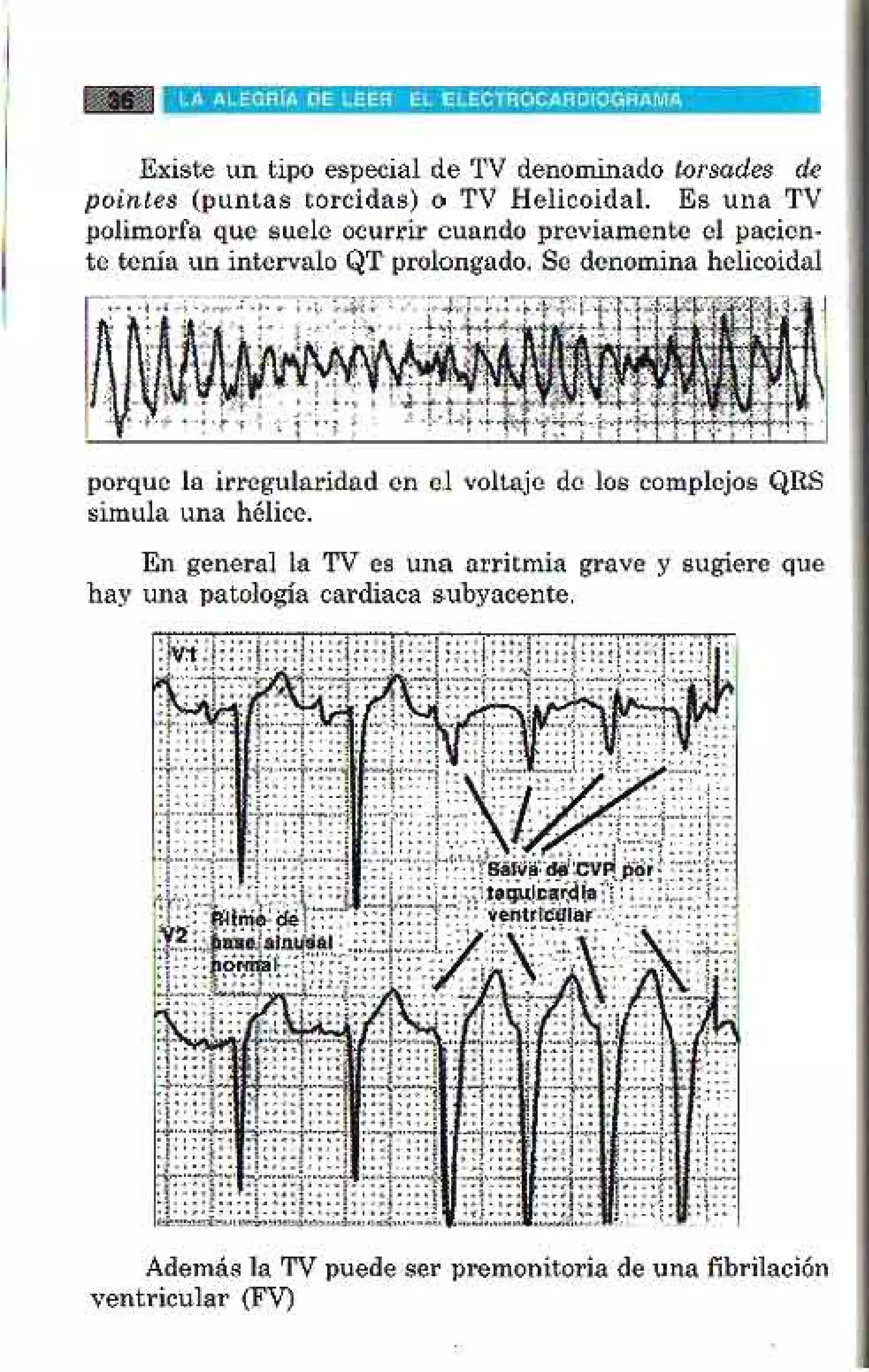 LA ALEGRIA DE LEER EL ELECTROCARDIOGRAMA