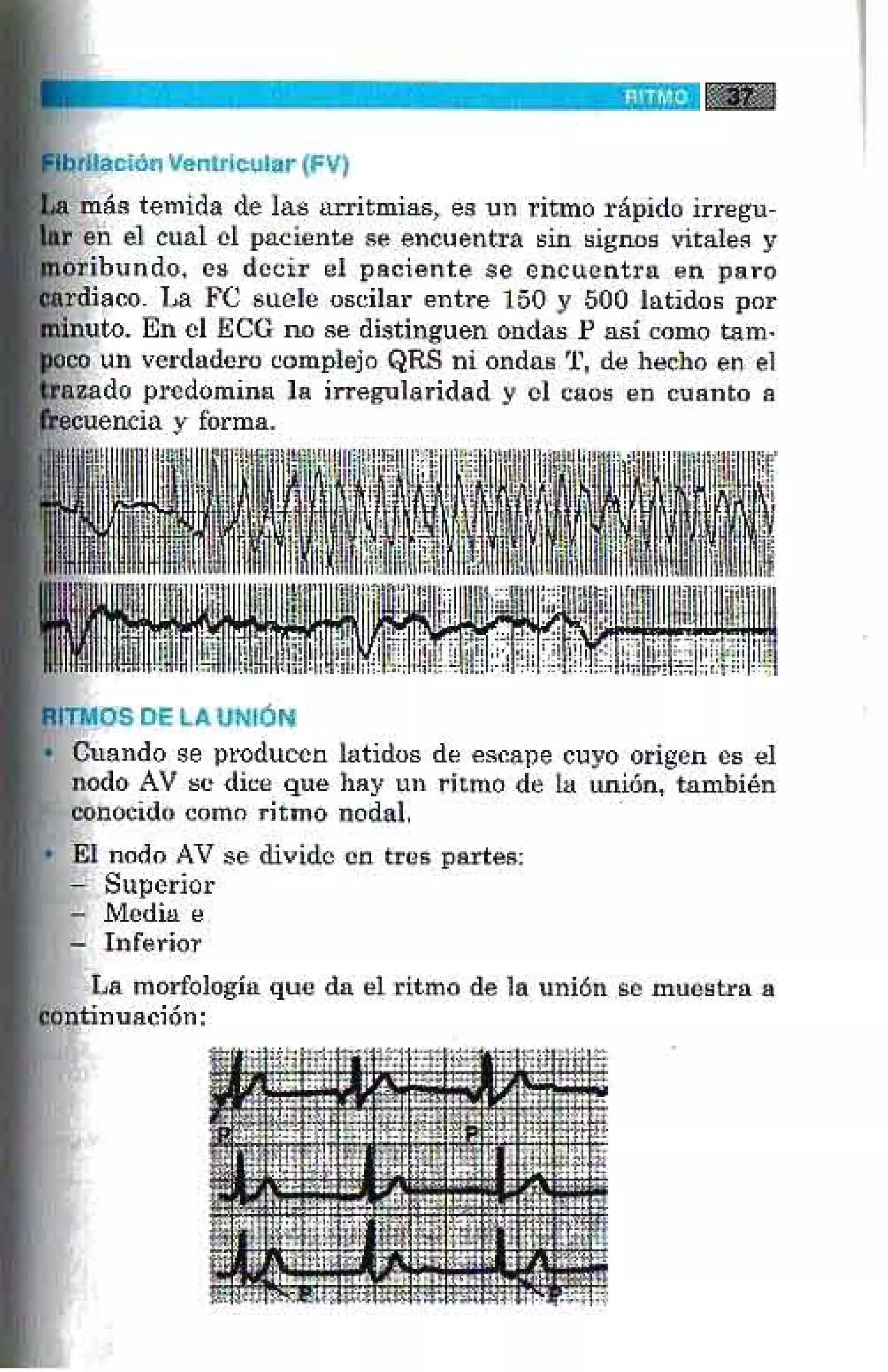 LA ALEGRIA DE LEER EL ELECTROCARDIOGRAMA