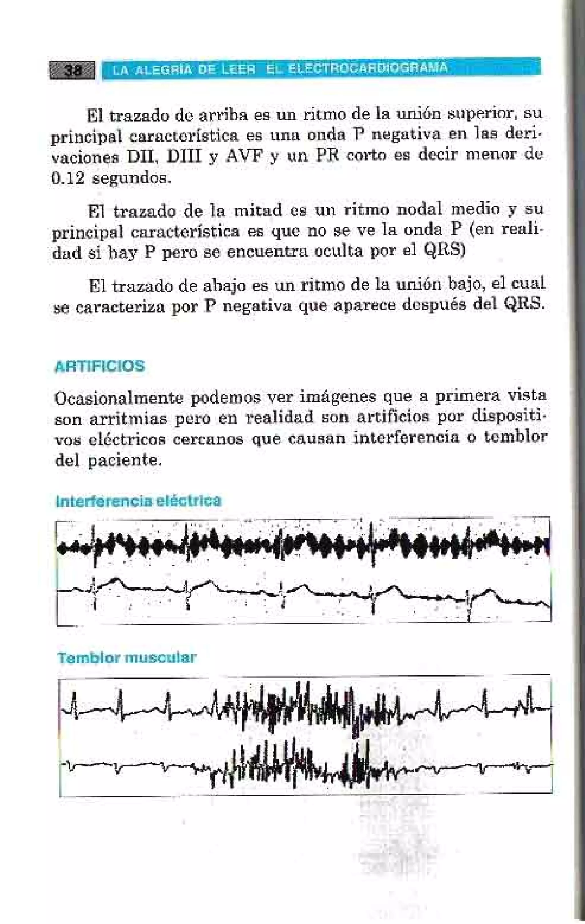 LA ALEGRIA DE LEER EL ELECTROCARDIOGRAMA