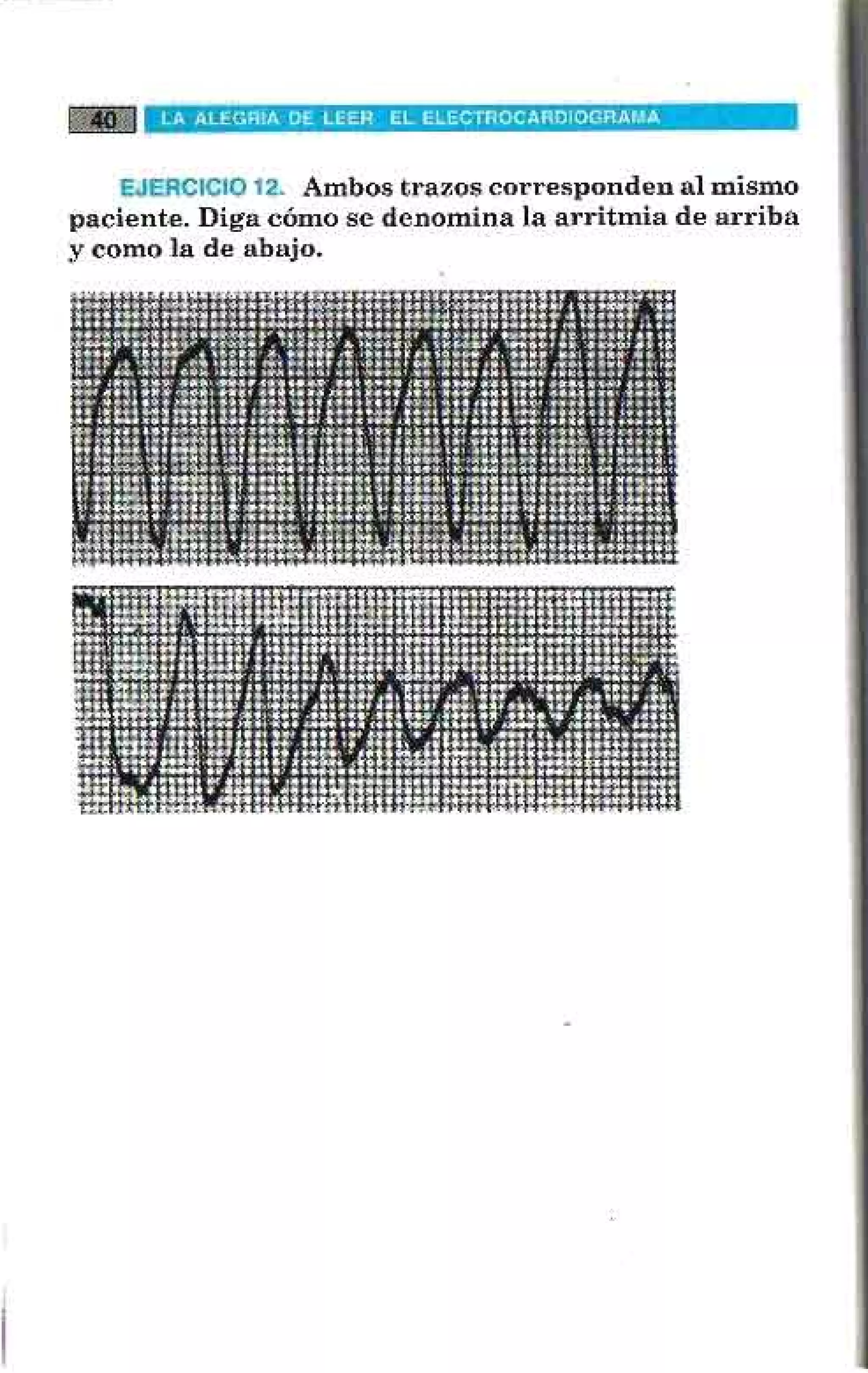 LA ALEGRIA DE LEER EL ELECTROCARDIOGRAMA