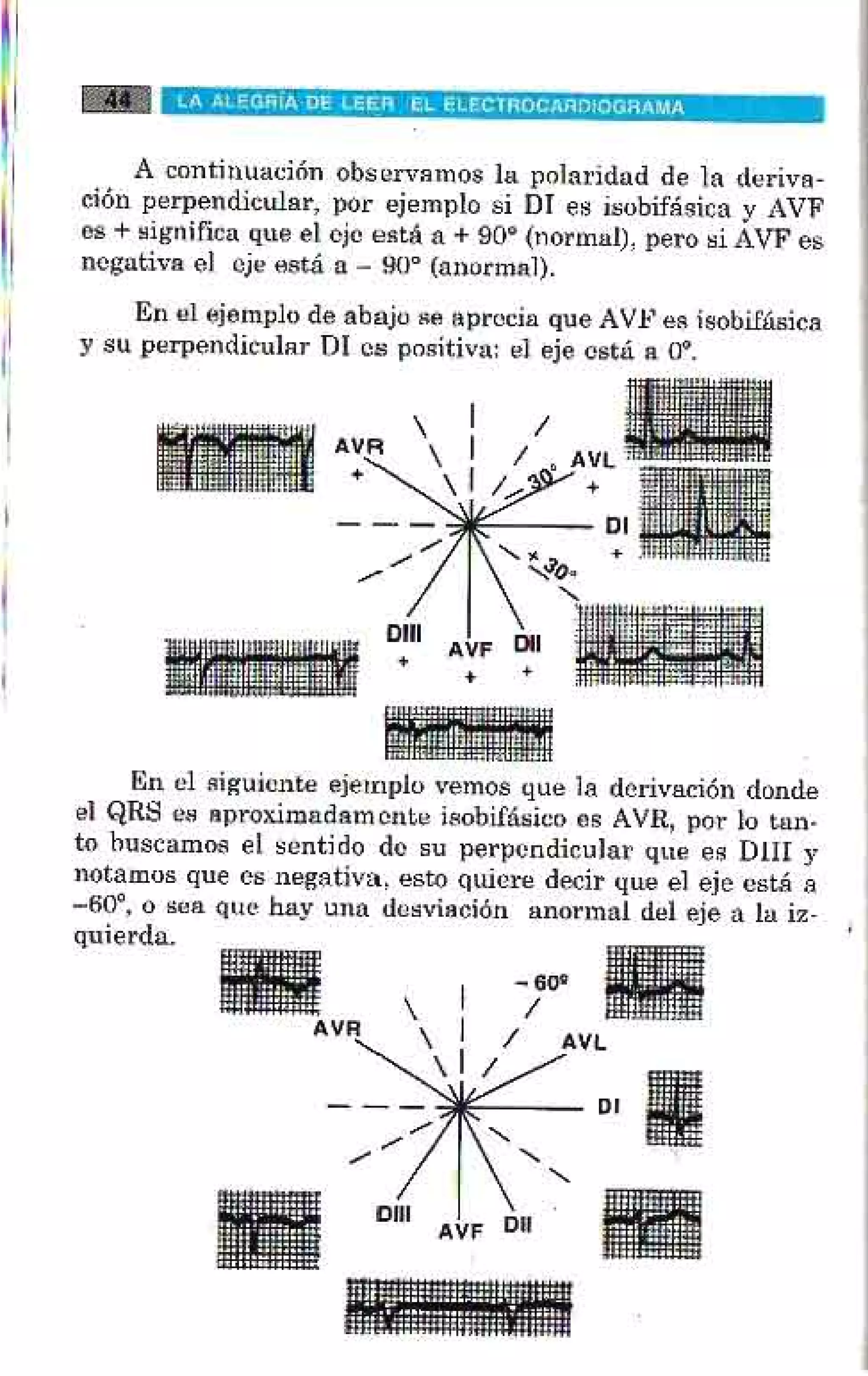 LA ALEGRIA DE LEER EL ELECTROCARDIOGRAMA