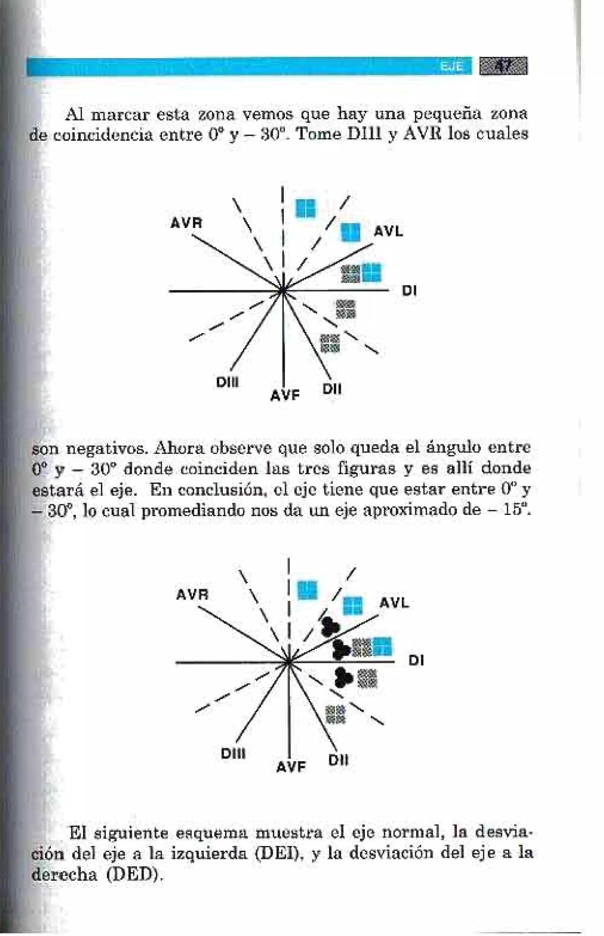 LA ALEGRIA DE LEER EL ELECTROCARDIOGRAMA