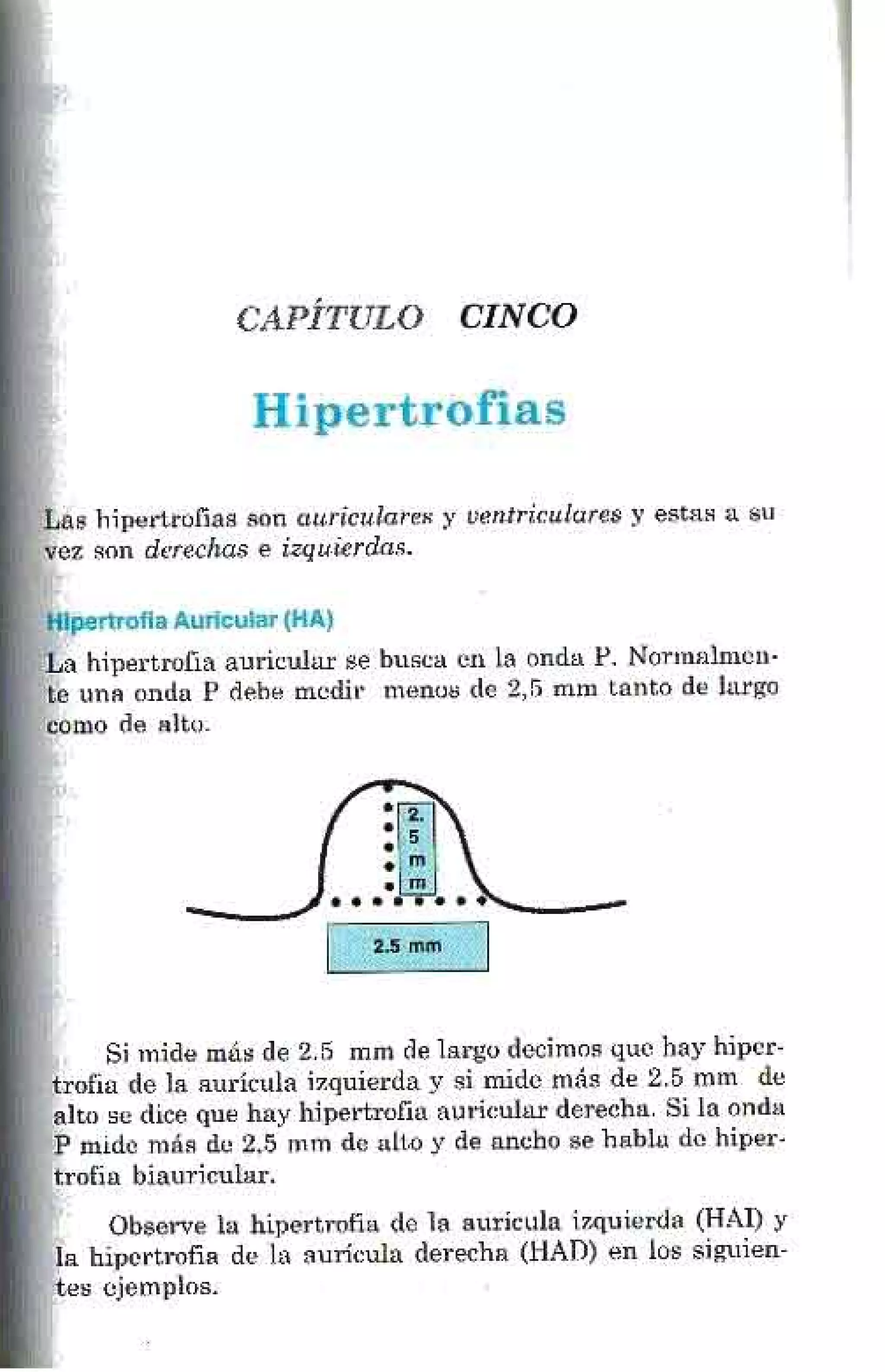 LA ALEGRIA DE LEER EL ELECTROCARDIOGRAMA