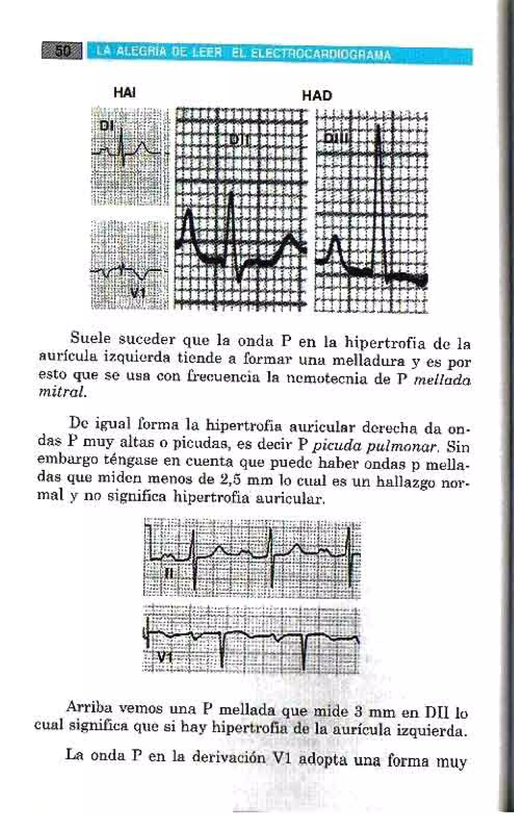 LA ALEGRIA DE LEER EL ELECTROCARDIOGRAMA