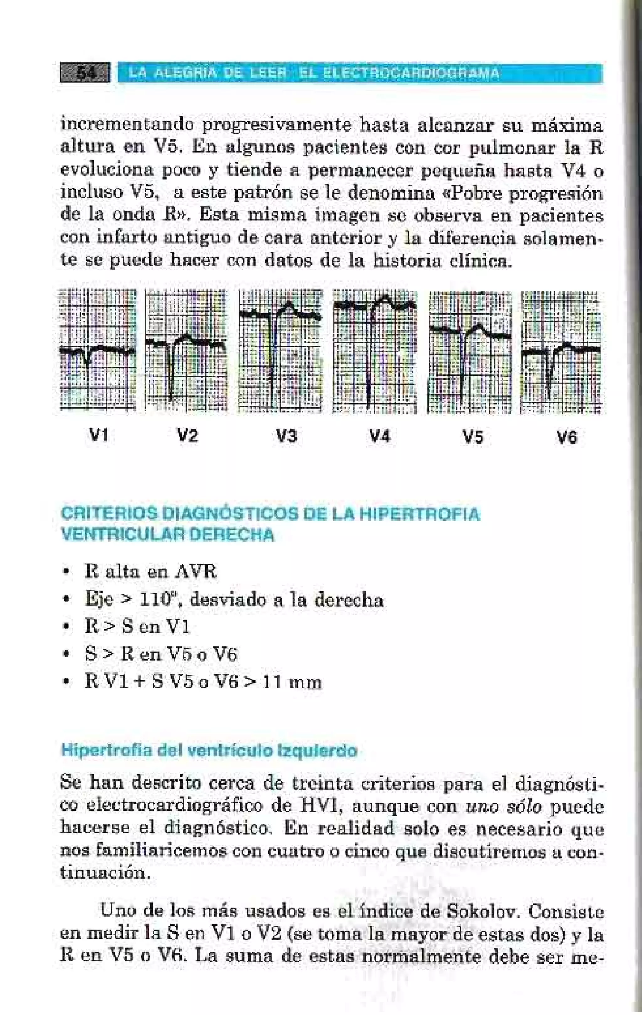 LA ALEGRIA DE LEER EL ELECTROCARDIOGRAMA