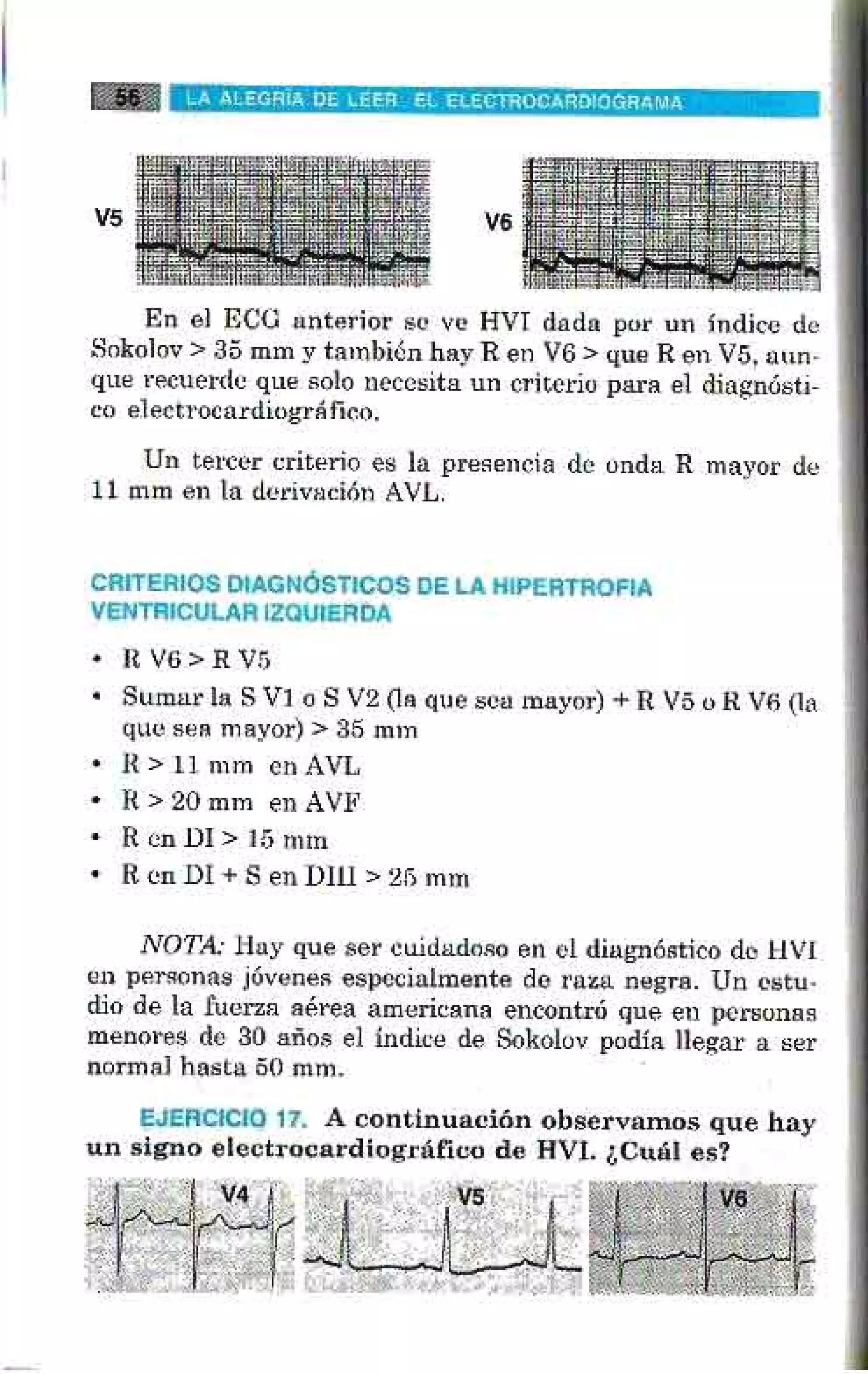 LA ALEGRIA DE LEER EL ELECTROCARDIOGRAMA