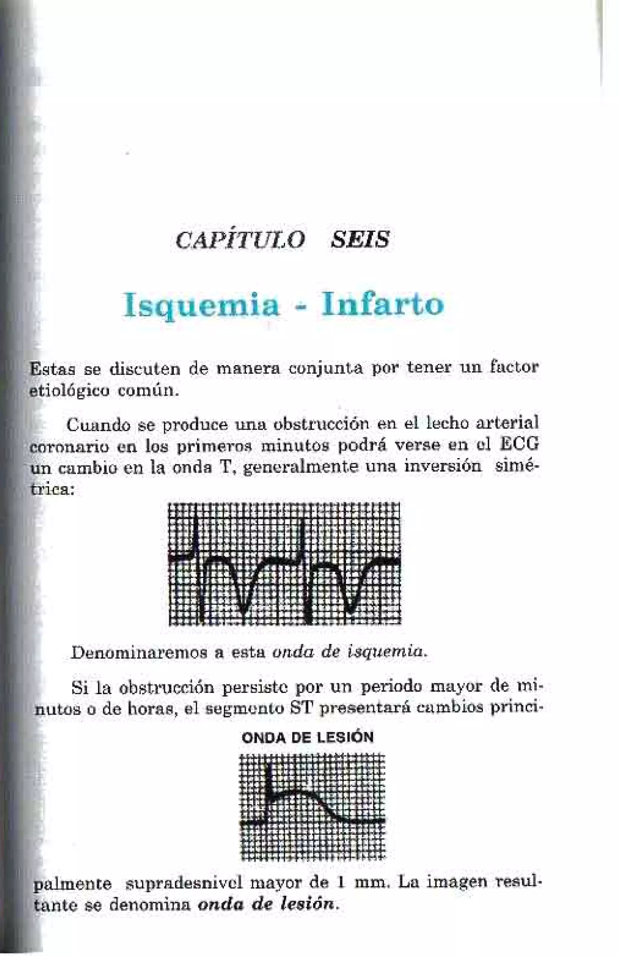 LA ALEGRIA DE LEER EL ELECTROCARDIOGRAMA