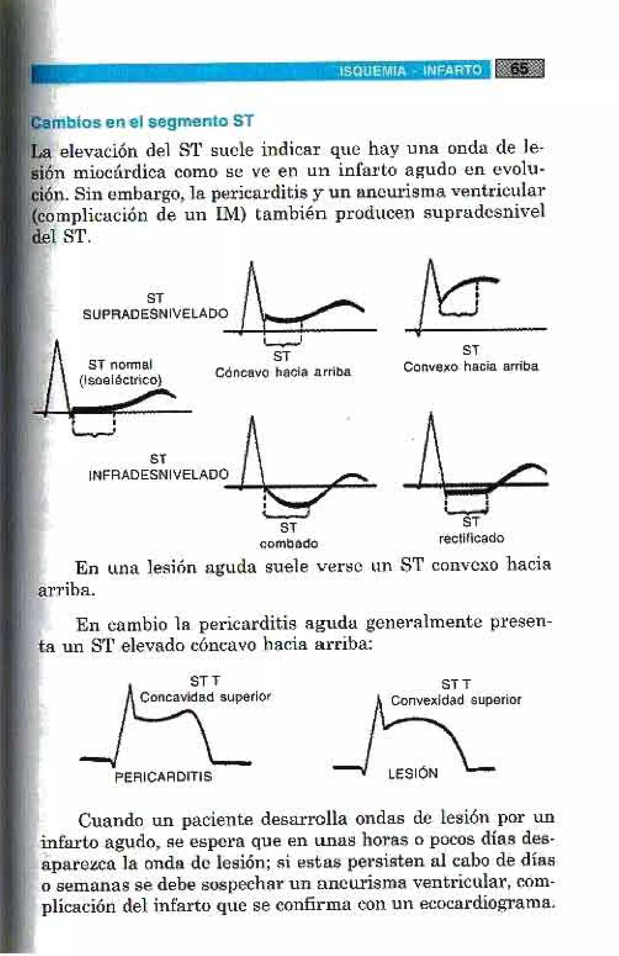 LA ALEGRIA DE LEER EL ELECTROCARDIOGRAMA